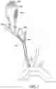 Fig. 05 - SYSTEMS AND METHODS FOR TRANSCATHETER AORTIC VALVE TREATMENT
