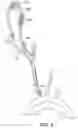 Fig. 06 - SYSTEMS AND METHODS FOR TRANSCATHETER AORTIC VALVE TREATMENT