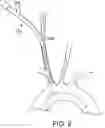 Fig. 07 - SYSTEMS AND METHODS FOR TRANSCATHETER AORTIC VALVE TREATMENT