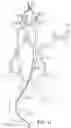 Fig. 09 - SYSTEMS AND METHODS FOR TRANSCATHETER AORTIC VALVE TREATMENT