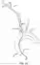 Fig. 11 - SYSTEMS AND METHODS FOR TRANSCATHETER AORTIC VALVE TREATMENT