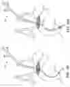 Fig. 14 - SYSTEMS AND METHODS FOR TRANSCATHETER AORTIC VALVE TREATMENT