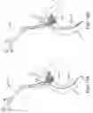 Fig. 15 - SYSTEMS AND METHODS FOR TRANSCATHETER AORTIC VALVE TREATMENT