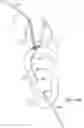 Fig. 16 - SYSTEMS AND METHODS FOR TRANSCATHETER AORTIC VALVE TREATMENT
