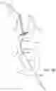 Fig. 17 - SYSTEMS AND METHODS FOR TRANSCATHETER AORTIC VALVE TREATMENT