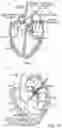 Fig. 02 - Prosthetic heart valve devices and associated systems and methods