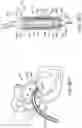 Fig. 14 - Prosthetic heart valve devices and associated systems and methods