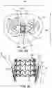 Fig. 19 - Prosthetic heart valve devices and associated systems and methods