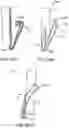 Fig. 34 - Prosthetic heart valve devices and associated systems and methods