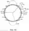 Fig. 40 - Prosthetic heart valve devices and associated systems and methods