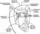 Fig. 01 - DEVICES, SYSTEMS AND METHODS FOR COLLAPSIBLE AND EXPANDABLE IMPLANT LOADING, TRANSSEPTAL DELIVERY, POSITIONING DEPLOYMENT AND REPOSITIONING DEPLOYMENT