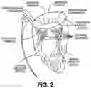 Fig. 03 - DEVICES, SYSTEMS AND METHODS FOR COLLAPSIBLE AND EXPANDABLE IMPLANT LOADING, TRANSSEPTAL DELIVERY, POSITIONING DEPLOYMENT AND REPOSITIONING DEPLOYMENT