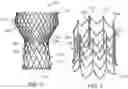 Fig. 03 - Devices and methods for transcatheter valve loading and implantation
