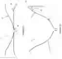 Fig. 09 - Systems and methods for treating cardiac dysfunction
