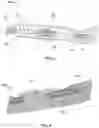 Fig. 02 - Bioactive soft tissue implant and methods of manufacture and use thereof