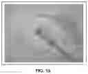 Fig. 16 - Bioactive soft tissue implant and methods of manufacture and use thereof
