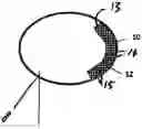 Fig. 01 - Bone prosthesis and method for its placement