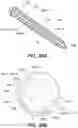 Fig. 12 - SYSTEMS AND METHODS FOR FUSION OF SACROILIAC JOINT