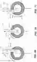 Fig. 35 - SYSTEMS AND METHODS FOR FUSION OF SACROILIAC JOINT