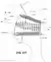 Fig. 50 - SYSTEMS AND METHODS FOR FUSION OF SACROILIAC JOINT