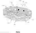 Fig. 04 - Implant with improved bone contact