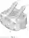 Fig. 03 - Body density scan result-matched orthopedic implants and methods of use