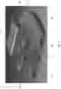 Fig. 05 - DYNAMIC LIGAMENT BALANCING SYSTEM