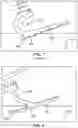 Fig. 07 - Shape optimization for prosthetic feet