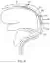Fig. 07 - Directional stent for accessing extravascular spaces