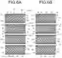Fig. 05 - Stent