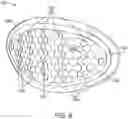 Fig. 09 - Sweat pad and methods of using same