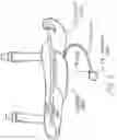 Fig. 06 - Inflatable flexion-correcting knee brace