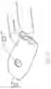 Fig. 08 - Inflatable flexion-correcting knee brace