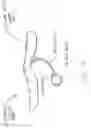 Fig. 14 - Inflatable flexion-correcting knee brace