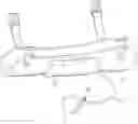 Fig. 01 - Inflatable flexion-correcting knee brace