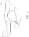 Fig. 14 - Inflatable flexion-correcting knee brace