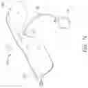 Fig. 15 - Inflatable flexion-correcting knee brace
