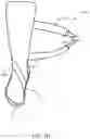 Fig. 03 - Method of manufacturing an ankle foot orthosis