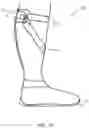 Fig. 04 - Method of manufacturing an ankle foot orthosis