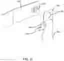 Fig. 13 - Method of manufacturing an ankle foot orthosis