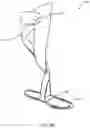 Fig. 24 - Method of manufacturing an ankle foot orthosis