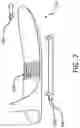 Fig. 29 - Method of manufacturing an ankle foot orthosis