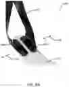 Fig. 31 - Method of manufacturing an ankle foot orthosis