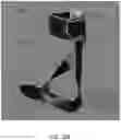 Fig. 39 - Method of manufacturing an ankle foot orthosis
