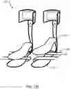 Fig. 42 - Method of manufacturing an ankle foot orthosis