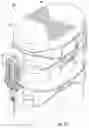 Fig. 02 - Distractive and mobility-enabling lumbar spinal orthosis devices, systems, and methods for treating mechanical low back pain
