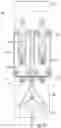 Fig. 17 - Distractive and mobility-enabling lumbar spinal orthosis devices, systems, and methods for treating mechanical low back pain