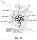 Fig. 10 - Accessory devices of a medical system, and related methods for communicating leakage state