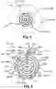 Fig. 06 - Data collection schemes for a medical appliance and related methods