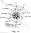 Fig. 10 - Data collection schemes for a medical appliance and related methods